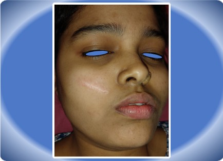 SCAR FACE